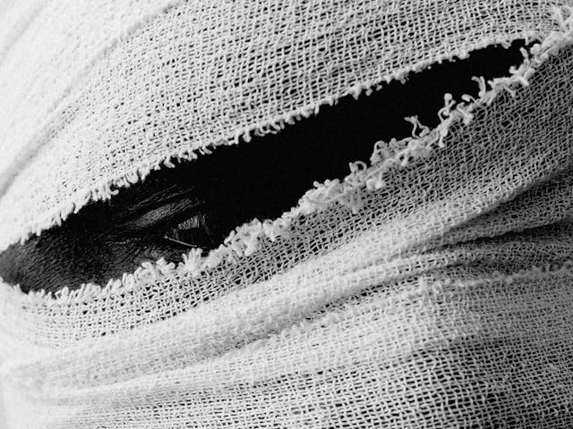 A closeup of a persons face completely wrapped in bandages, through a small slit you can an eye.